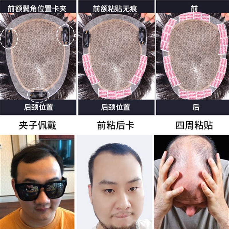 假发男短发寸头真发帅气隐形假发片头顶补发秃顶真人发丝男士假发