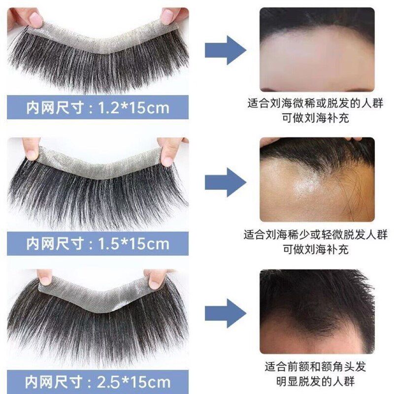 男士隐形生物膜发际线假发贴 自然逼真补发片 无痕M型额头设计