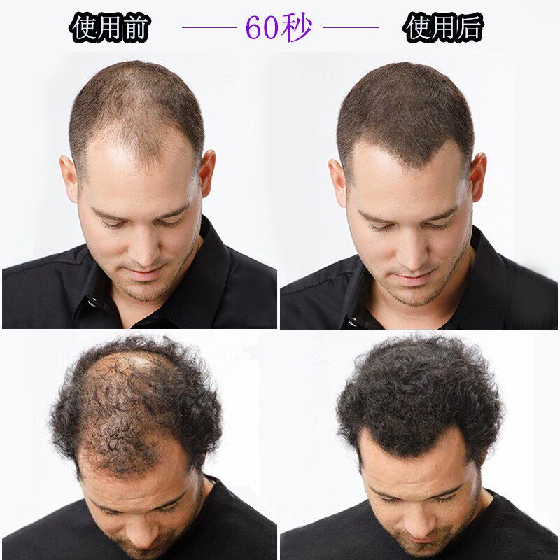 密丰增发纤维假发补充包袋装男女快补发密发美发掉头发多浓发70g