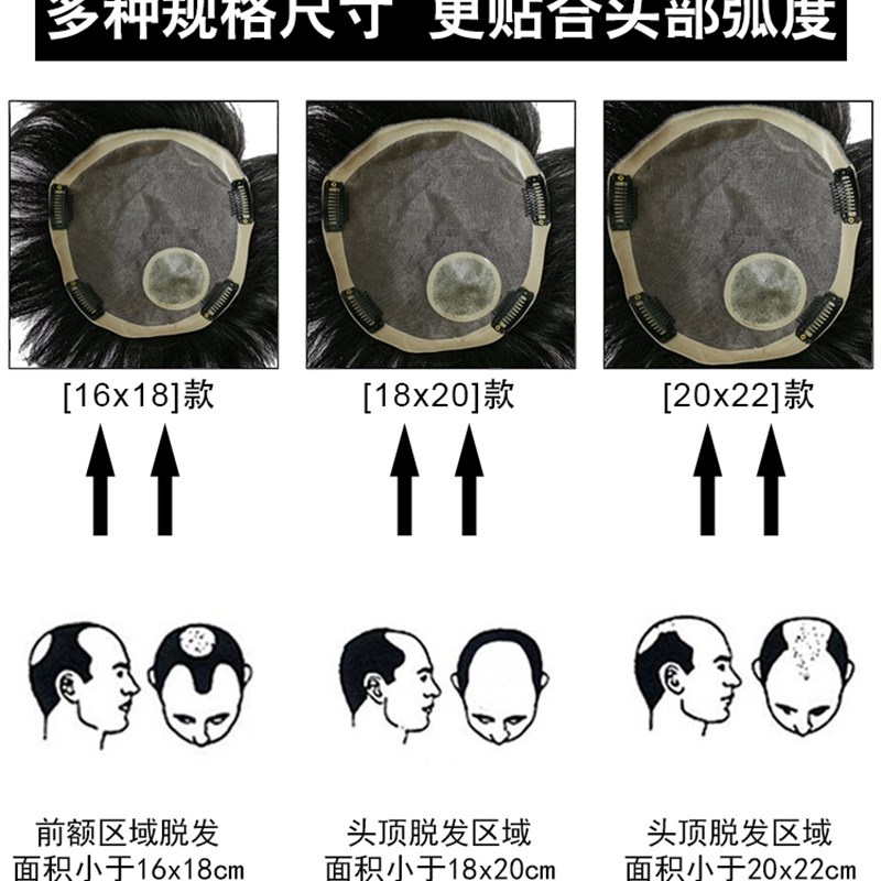男士补发片假发套头顶补发前额秃顶补发接发假发真发男发块假发片