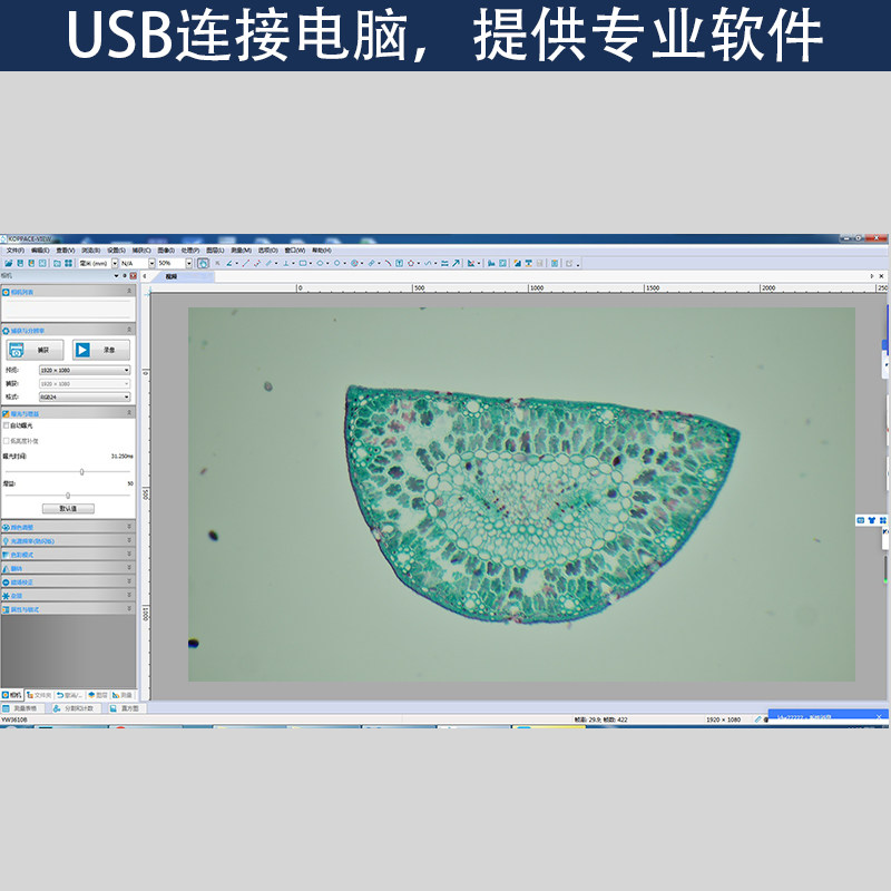 包邮 40X-2500X高清生物显微镜200万像素9寸屏畜牧水产养殖显微镜