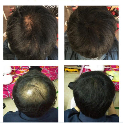 袋装toppik顶丰密发增发男女补发神器假发浓密头发蛋白纤维粉