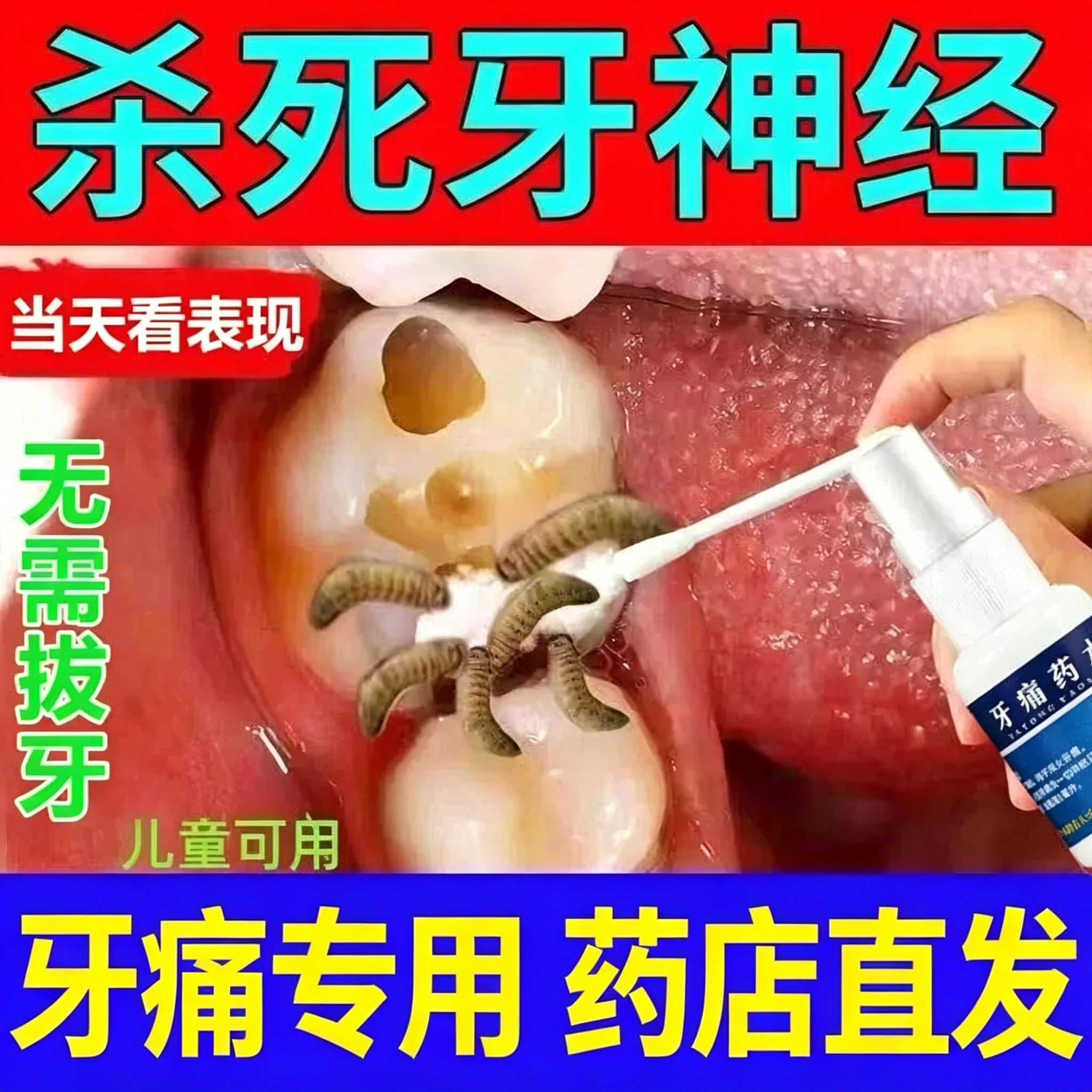 牙疼止疼药水速牙效消炎止痛杀神经特新效药牙龈肿痛牙痛专用药