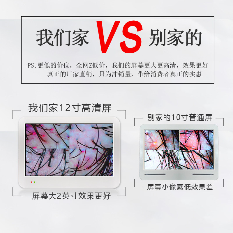 头皮检测仪毛囊高清理髲店头发测试仪器皮肤面部分析带屏幕All