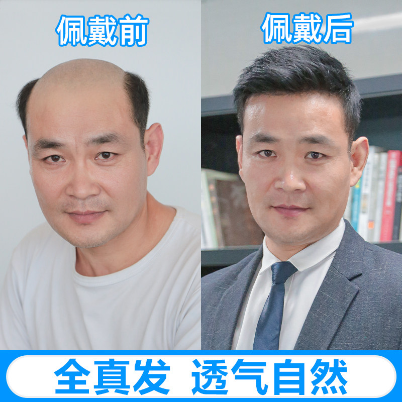 精递织发补发片男士假发男短发帅气韩版真人发丝秃顶头顶补发块