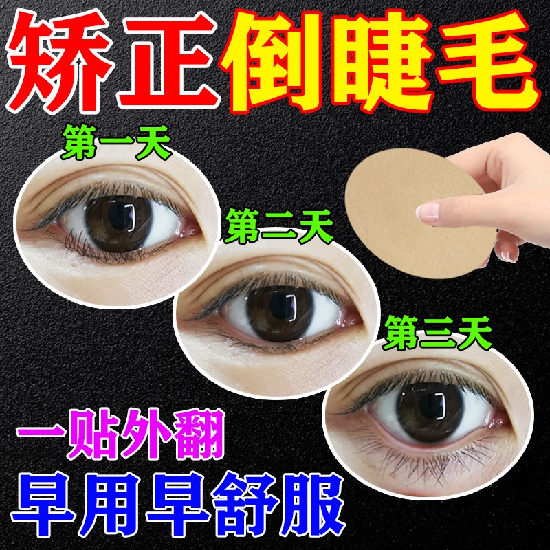 倒睫毛矫正贴儿童成人专用神器眼睑下垂外翻提拉内外翻拔倒刺眼贴
