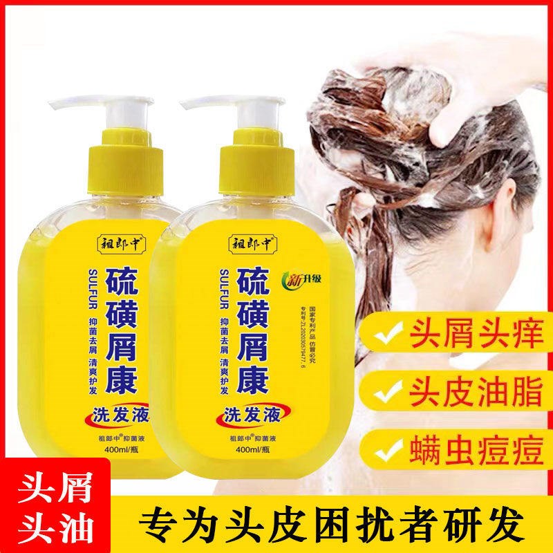 硫磺皂上海洗发水去头螨头皮屑脂溢性控油止痒升级配方硫磺洗发水