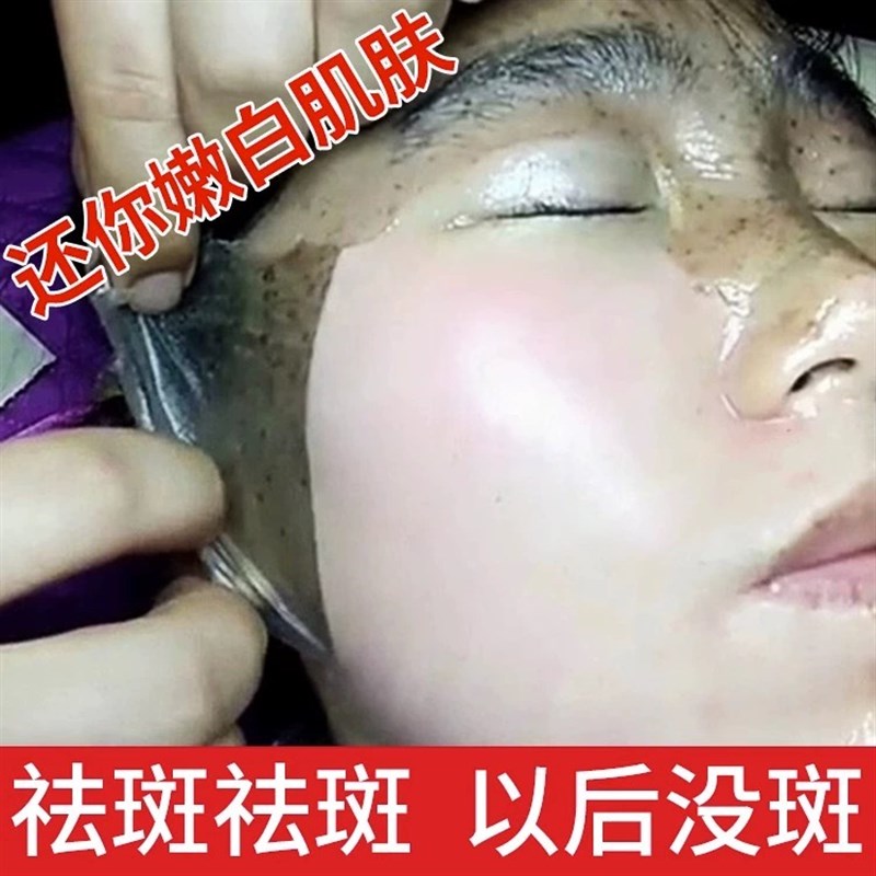 去脸上斑点黑色素 还你一个无瑕疵的脸蛋 秒变男女神【夏季优选】