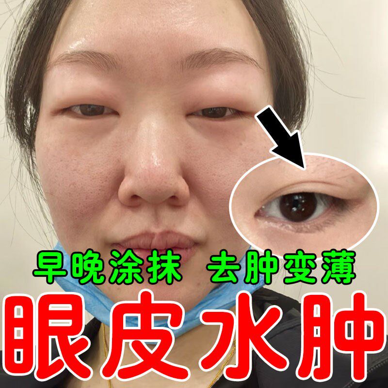 眼皮肿胀肿眼泡专用【正品】熬夜眼肿发黑松弛下垂专用眼部乳膏