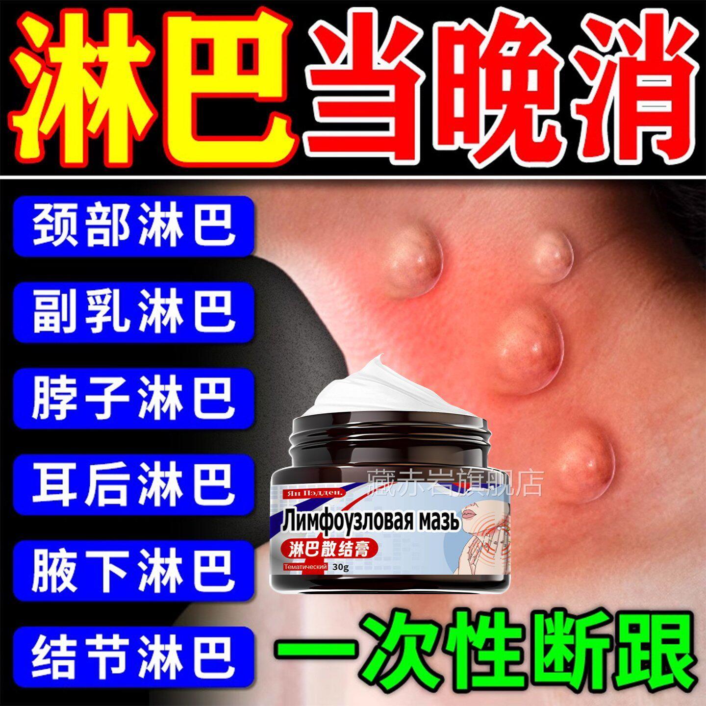 淋巴结消散膏散结脖子肿大颈部疏通除神器副乳去消贴腋下结节贴膏