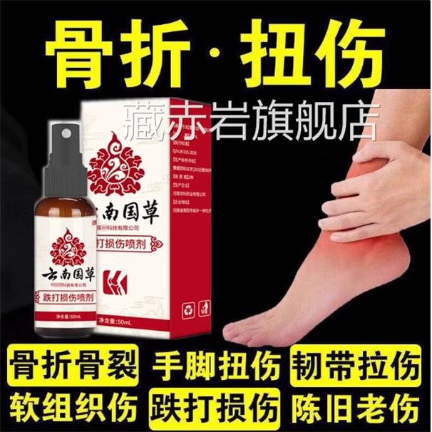 消肿止痛跌打损伤喷雾脚手腕脚踝崴摔倒扭伤筋骨疼痛韧带拉伤肿胀