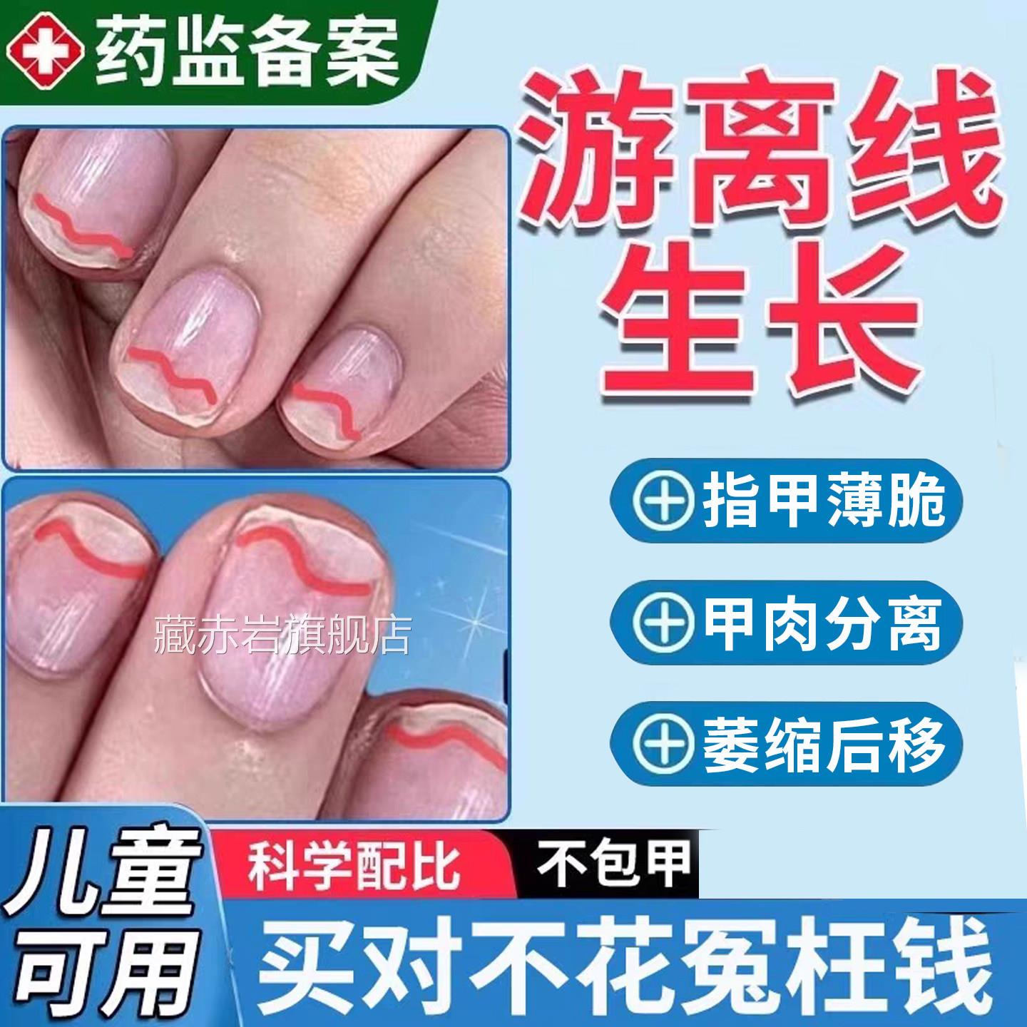 手指甲游离线生长液儿童空甲养甲肉分离修复液萎缩损再生受增长颜
