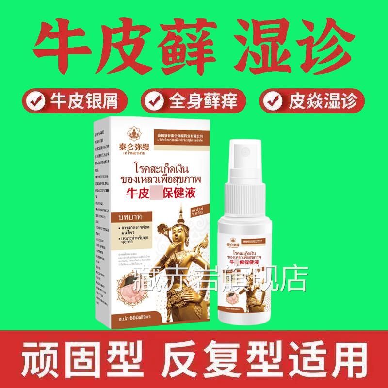 辅助治疗顽固牛皮癣银屑病专用大药房喷雾剂股正品膏体股癣手癣湿