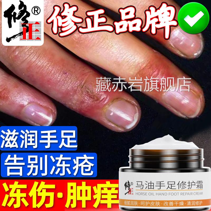 冻疮膏防止痒冻伤膏正品儿童裂口干裂冻手耳朵消肿防冻马油修复霜