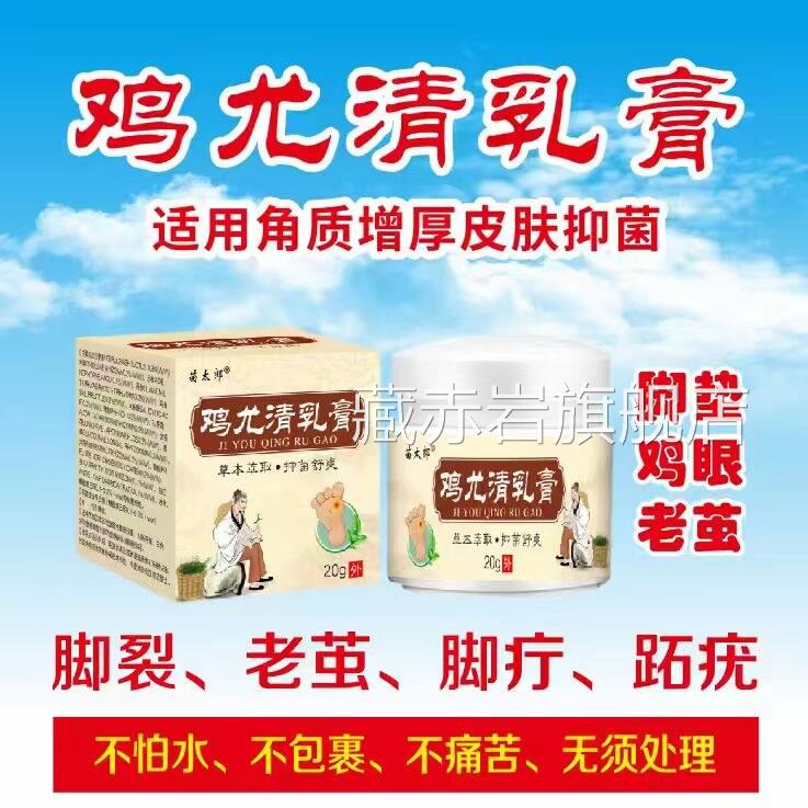 苗太郎尤清乳膏成人脚部鸡眼老茧皮肤护理抑菌膏去角质增厚鸡脚裂