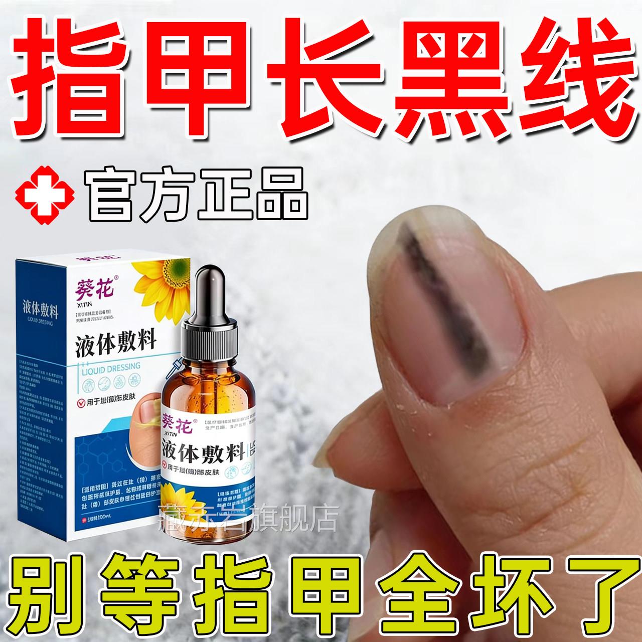 甲母痣指甲坏长黑线专用护理液手脚指甲淤血长黑褐色竖纹甲修复UU