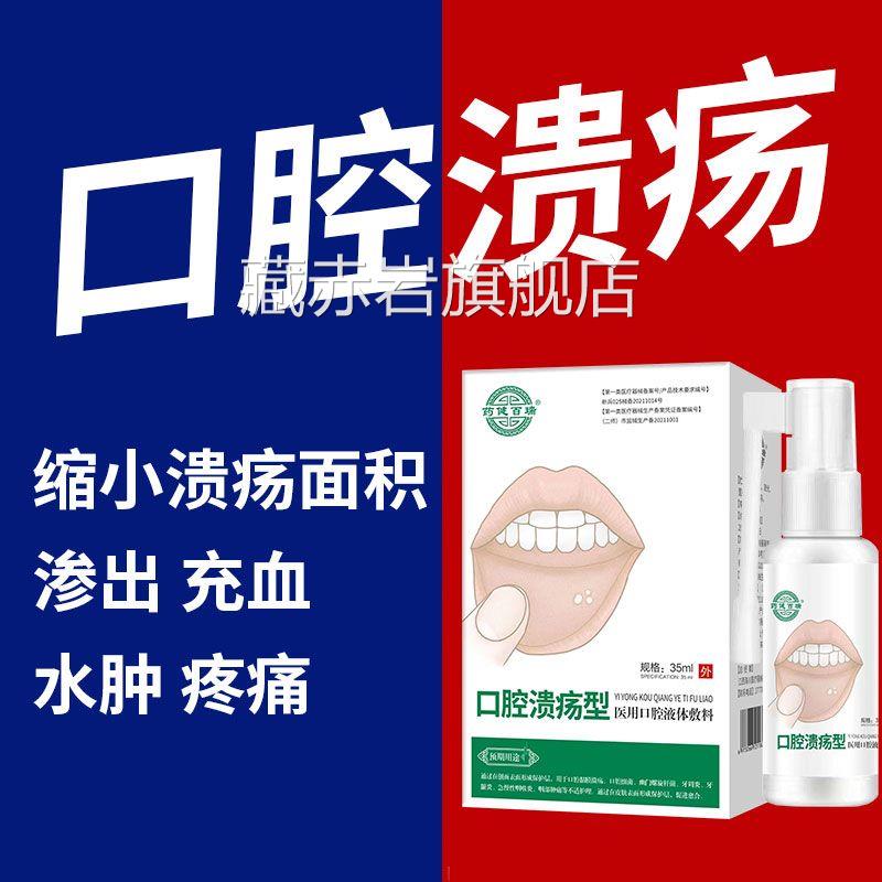 口腔溃疡修复液喷雾喷剂凝胶一点灵非药膏疡嘴巴舌头口舌起泡一滴