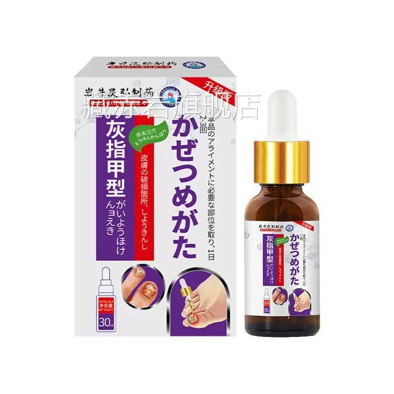 岩井昃弘制药灰指脚甲液真菌性白甲趾藓甲肉分离空甲变厚发黄抑菌