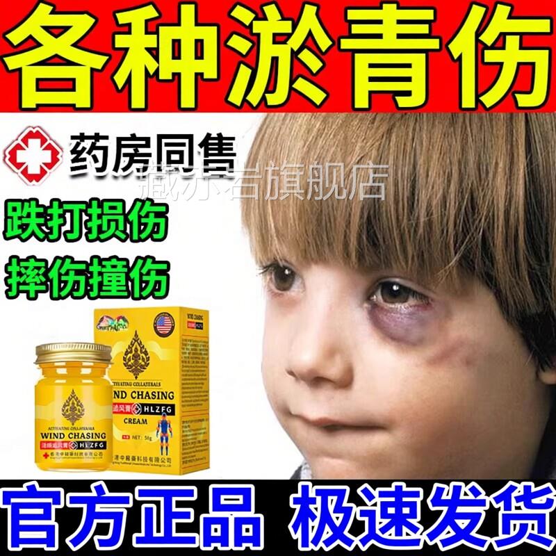 淤青膏快速消除宝宝淤膏眼部眼睛活血化瘀去淤青摔倒青膝盖腿磕碰