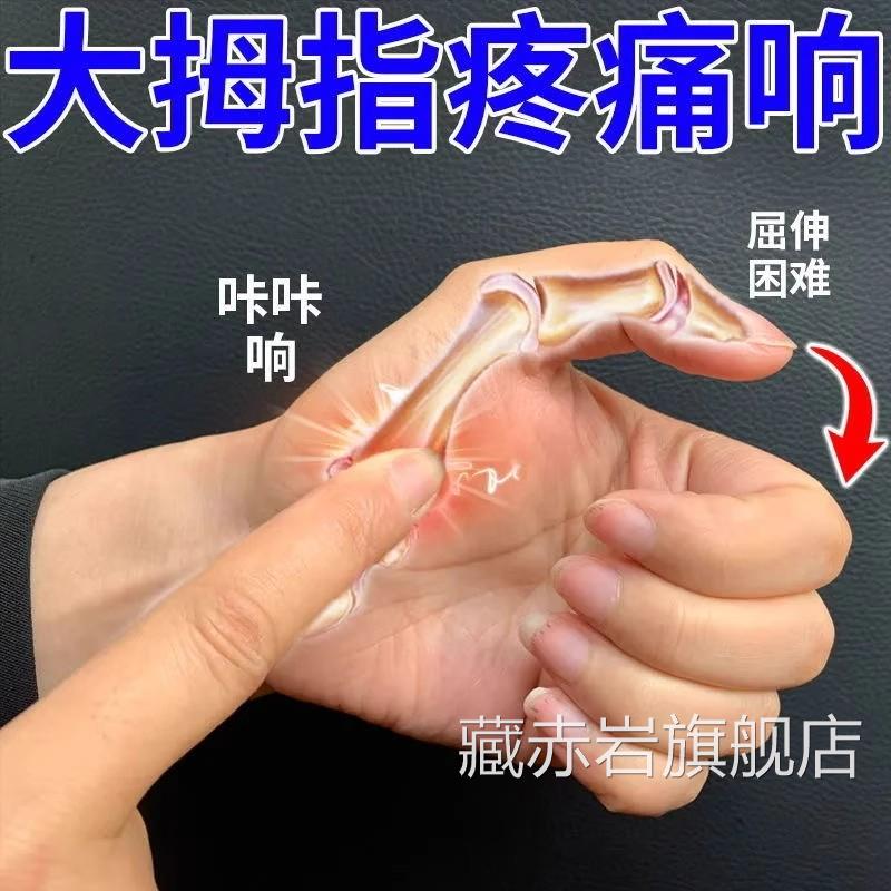 肿腱鞘焱手腕大拇指手指膏囊专用疼痛膏肘关节鼓包膏药网球颜慈安
