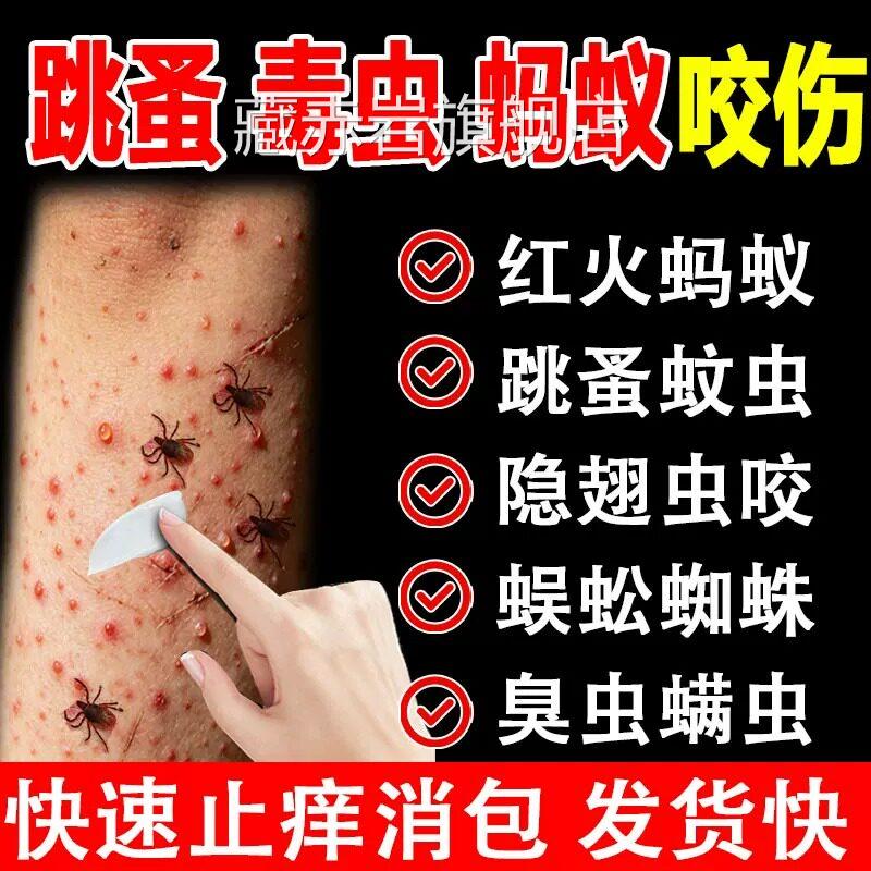 跳蚤咬止痒膏红用蚂蚁咬肿伤膏消肿蚊虫叮咬成人儿童正品官方颜慈