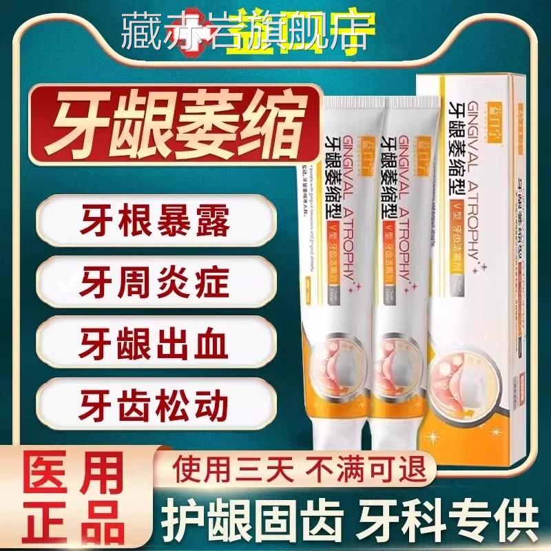 益店口宁官方旗舰正品牙齿松动牙膏牙周炎溢口腔牙龈萎缩洁离剂颜