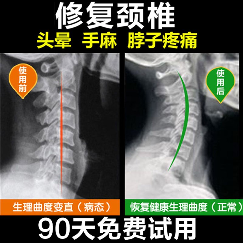 颈椎枕头芯颈椎专用反弓中秋实用礼物品牵引荞麦决明子圆形护颈枕