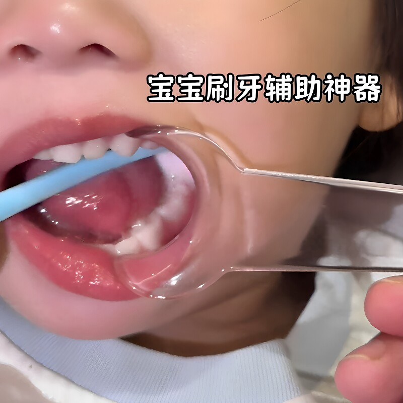儿童刷牙辅助器嘴巴扩展省力开口器家用婴儿宝宝口腔污垢清洁神器