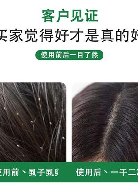 篦子梳虱子梳木头儿童超密齿老式加密去头屑去虱卵刮头篦梳梳子