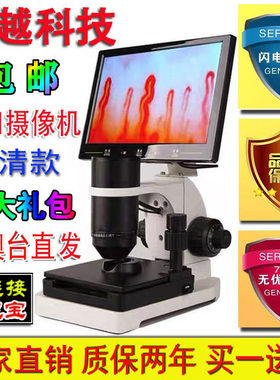 飞越高清880微型甲襞循环手指末梢血管观察仪 血流速检测仪显微镜