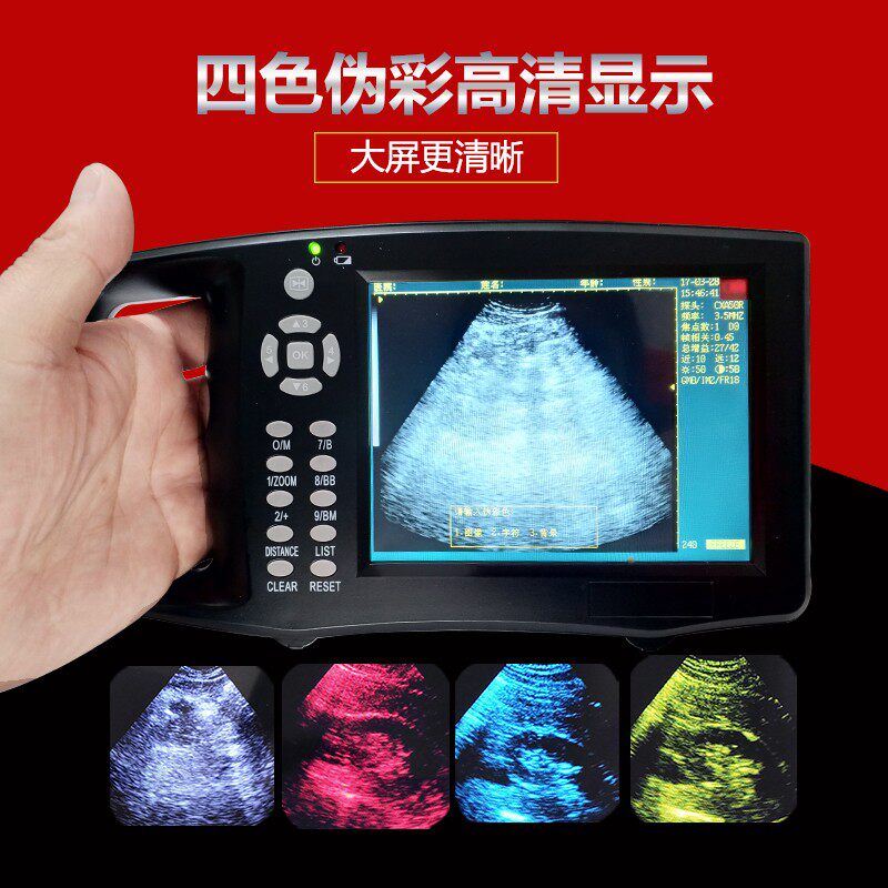 兽用B超机羊牛用测孕仪器猪用b超机畜牧b超机高清便携检孕仪新品