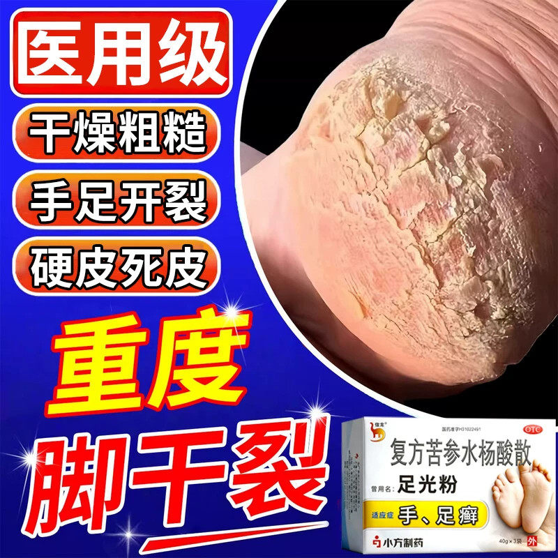 足光散粉复方苦参水杨酸散抗真菌脚气专用脚气止痒泡脚去真菌