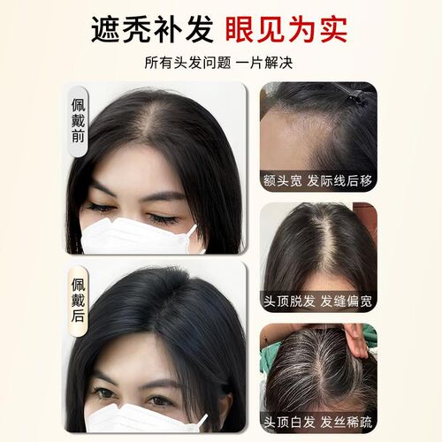 假发女片头顶全真发量蓬松遮白发补发片高颅顶夏季假发片刘海八字