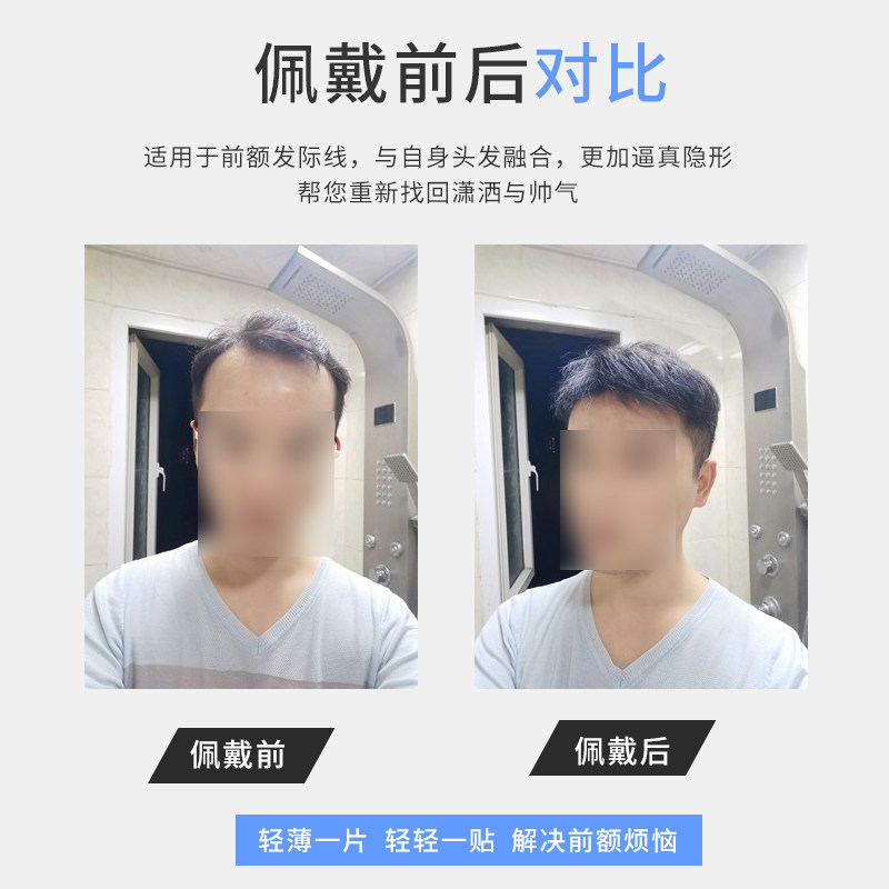 发际线假发贴男士补发片前额隐形生物头皮真发无痕M型额头假刘海