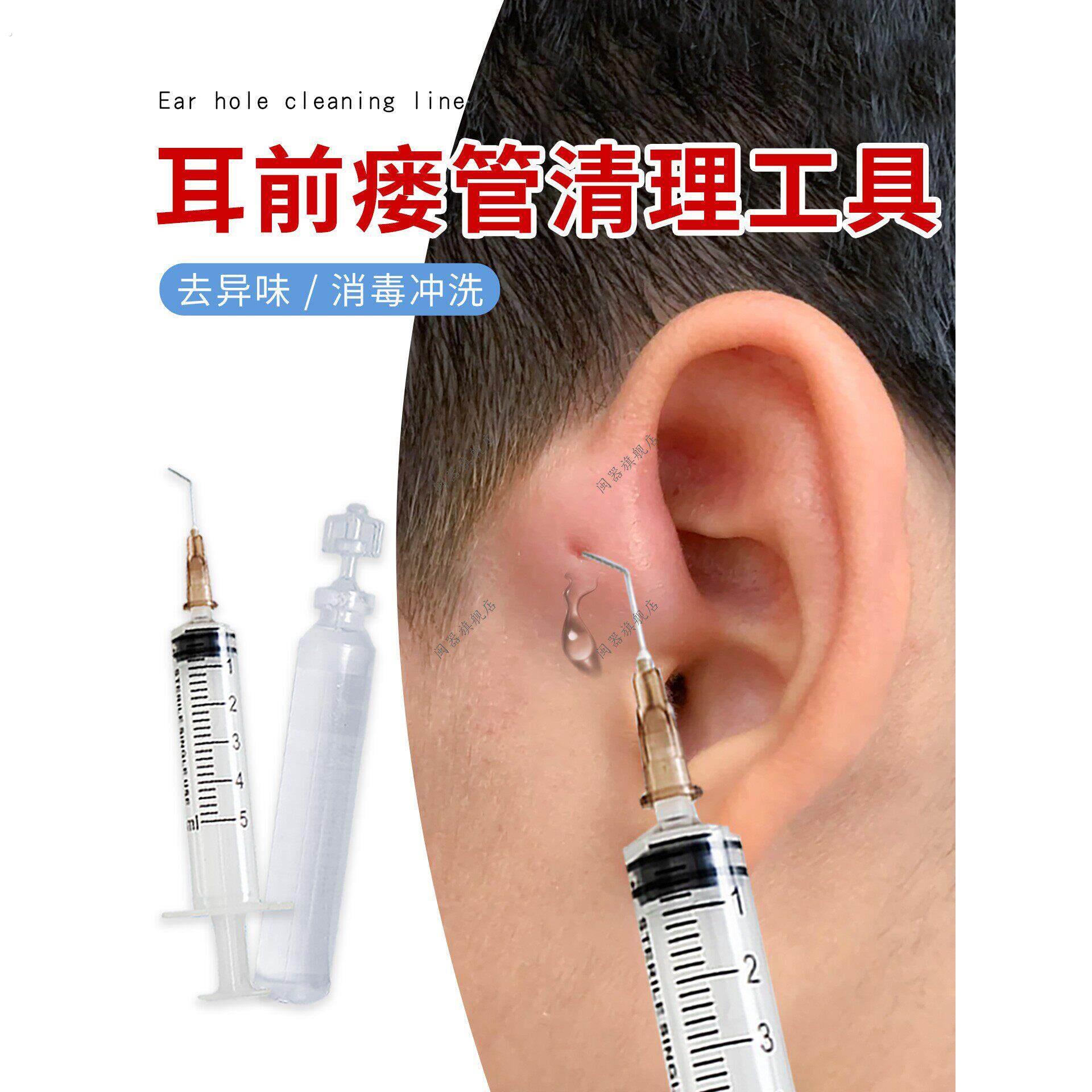耳前瘘管清理工具清洁耳瘘流脓耳仓发炎肿耳朵弯头外耳道洗耳针头