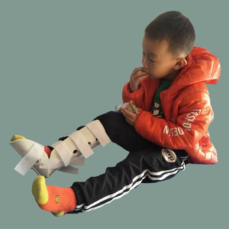 幼儿童踝关节固定支具小腿胫腓骨折脚腕扭伤固定护具脚踝骨折康复
