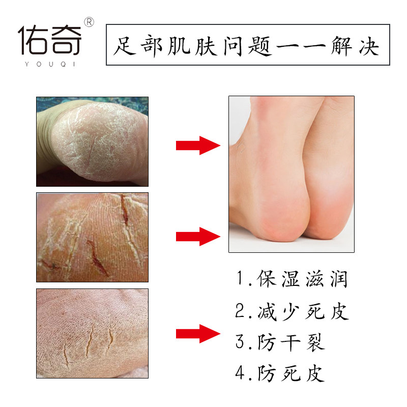 5双装佑奇 防裂袜 防裂袜子 男 全脚掌 全脚型 满脚心 脚裂袜厚棉