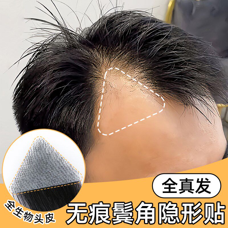 发际线假发贴男前额M型补发全y真人发假发片隐形无痕鬓角贴刘海片