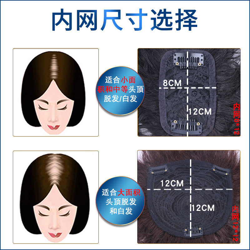 头顶补发片真发遮白发头顶蓬松卷发轻薄款玉米烫刘海假发顶发盖女