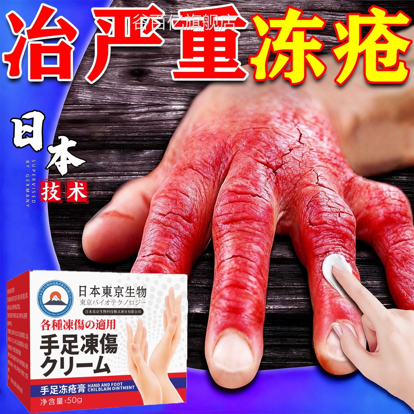 日本冻疮膏伤止痒膏防裂成人干裂冻抑菌膏冻耳朵脸部通用防冻霜谷