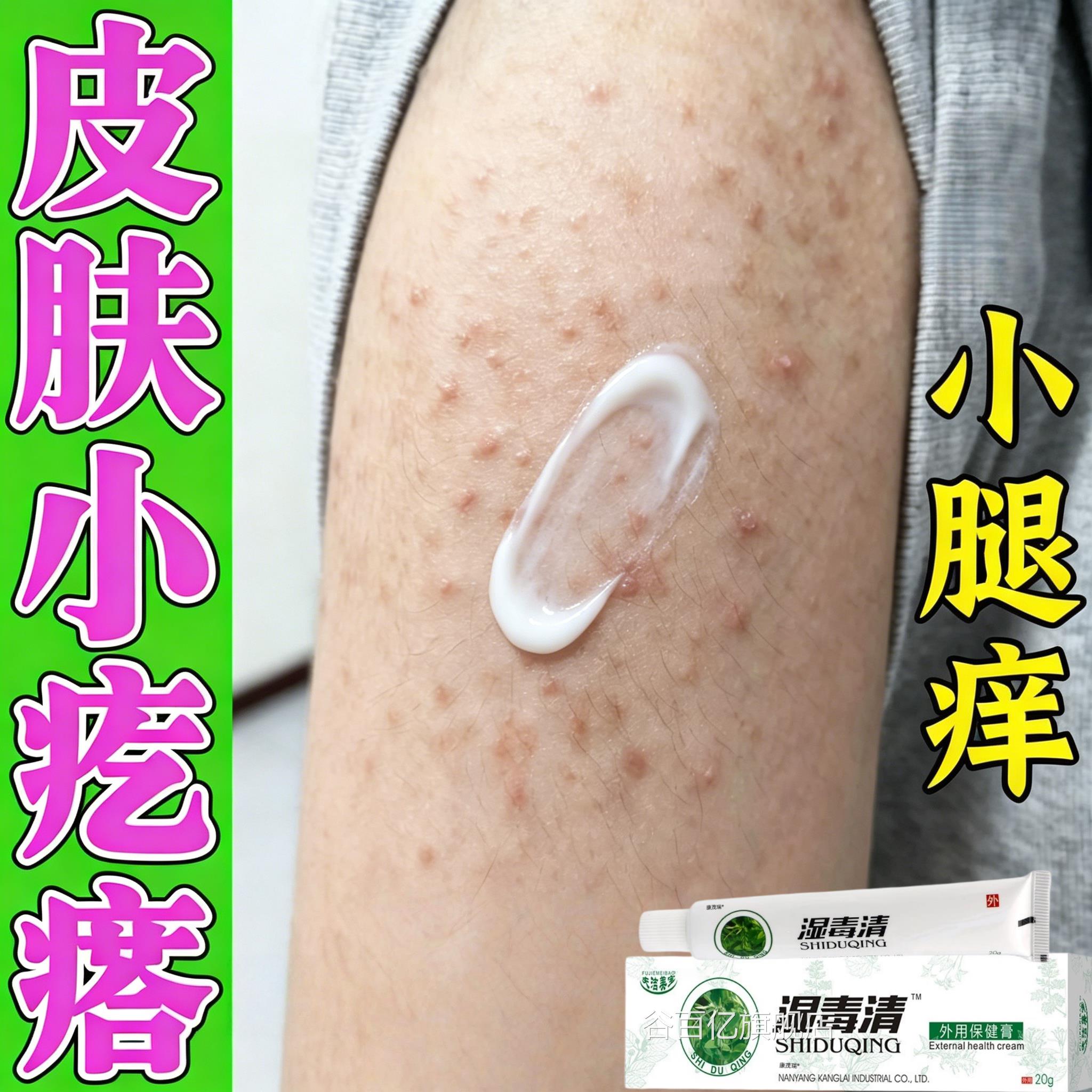 夏天小腿痒湿成人止膏出汗身上痒天热皮肤瘙痒疙瘩热红疹热毒谷百