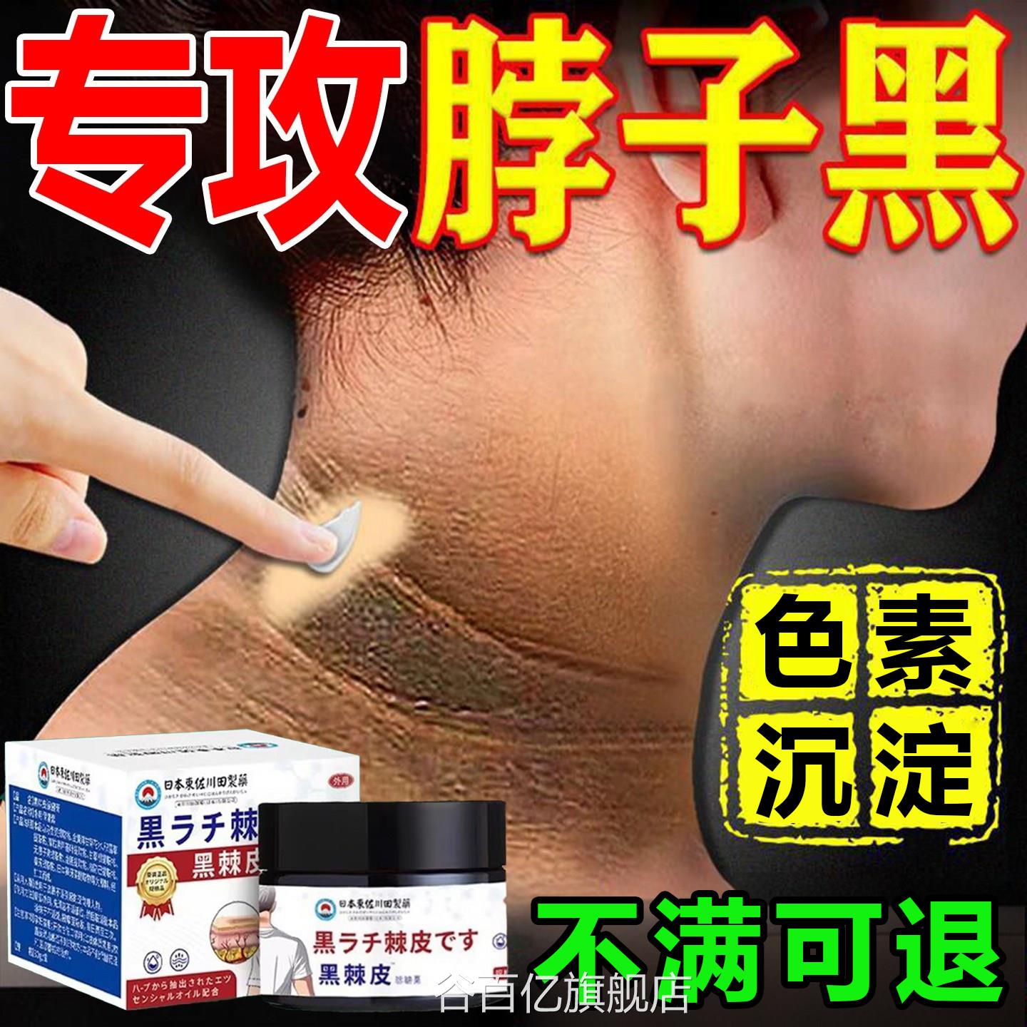 脖子黑色素去除黑棘皮症病去黑色素淀膏神器洗不沉干净美白净化谷