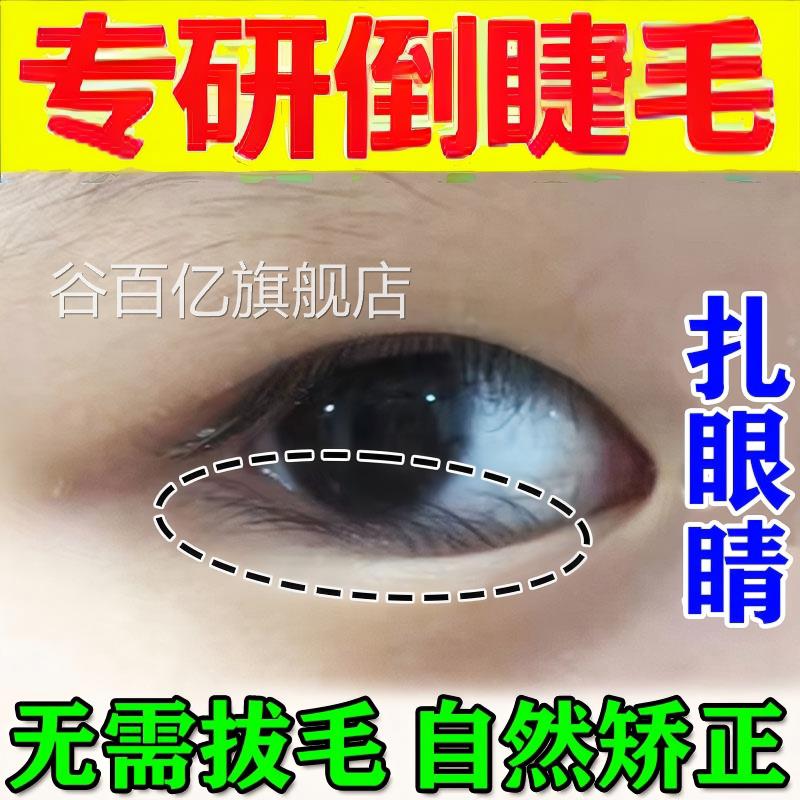 倒睫眼毛矫正贴成人婴儿睫毛倒长眼睑下垂提拉皮儿童专用神器正品