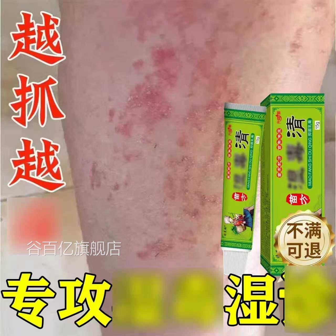 皮肤止痒膏湿毒清私处阴囊软膏去痒专用男女外用旗舰店瘙正品官方