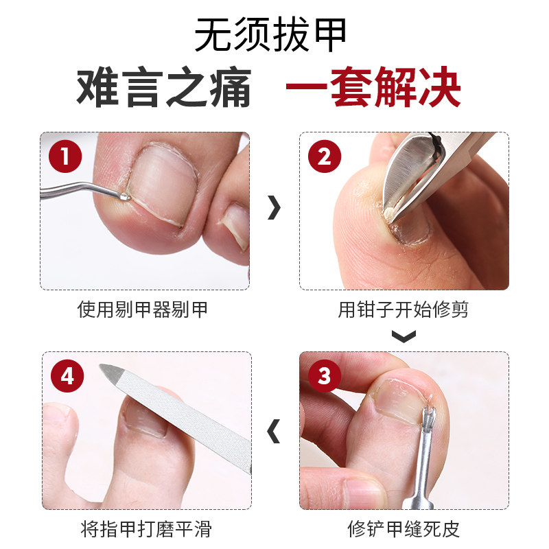 甲沟专用指甲剪刀鹰嘴脚趾甲剪套装鹰嘴钳尖嘴神器修脚工具钳子炎