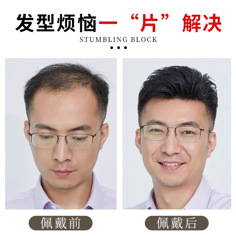 发际线假发贴男前额秃顶补发隐形无痕假发片精剪真发假刘海发片男