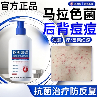 后背毛囊去除背上痘痘马拉色菌