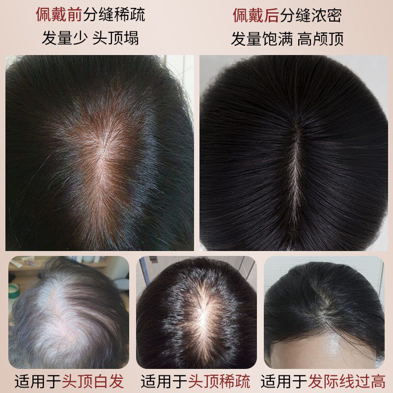芊亿头顶假发片女头发稀少遮白发隐形无痕蓬松真人发丝递针补发片