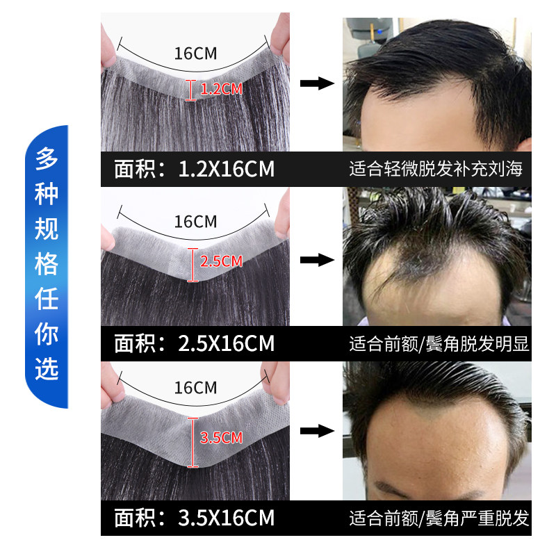 发际线贴假发男前额隐形补发片男士高额头秃顶真发隐形生物膜贴片