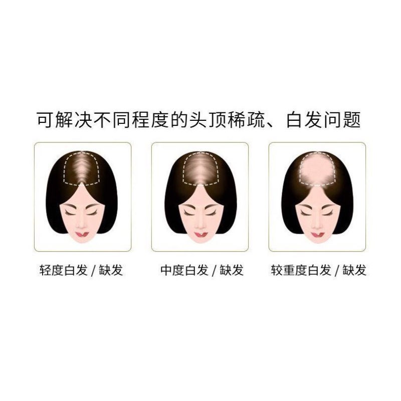 新款高档薄款刘海假发片真发自然魔术贴前额洋气2023款头顶补发卷